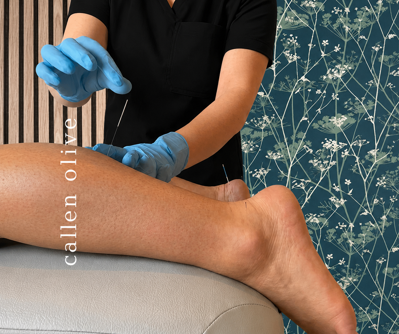 Acupuncture for Foot & Lower Limb Pain