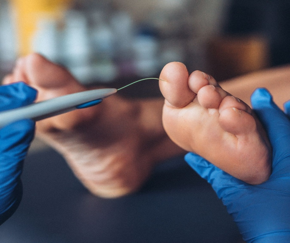 Essential Tips for Diabetic Foot Care: Protecting Your Feet Every Step of the Way