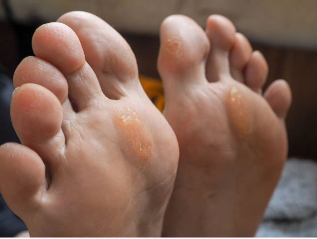 How to Get Rid of Hard Skin on Feet: Without Booking a Weekly Pedicure Appointment