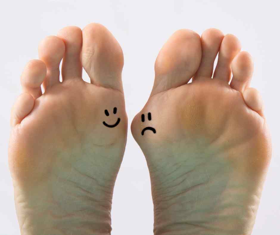 Callen_Olive_Berkamsted_podiatry_chiropody_clinic_Berkhamsted_near_Hemel_Hempstead_Tring_Bunions_Foot_Pain_bunion_causes_and_treatment Bunions | Causes | Prevention | Treatment hallux valgus 