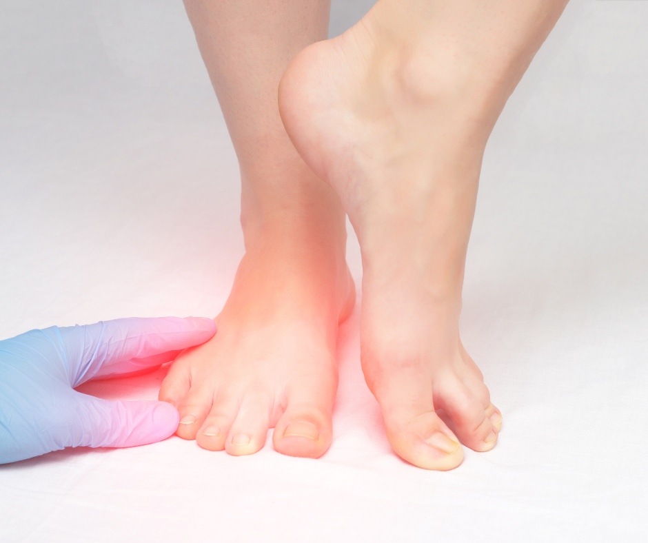 Callen_Olive_Podiatry_chiropody_Clinic_Berkhamsted_near_Hemel_Hempstead_and_Tring_arthritic_feet_painful_feet_osteoarthritis_in_feet_rheumatoid_arthritis_in_feet Arthritis Of The Foot & Ankle | Causes | Prevention | Treatment