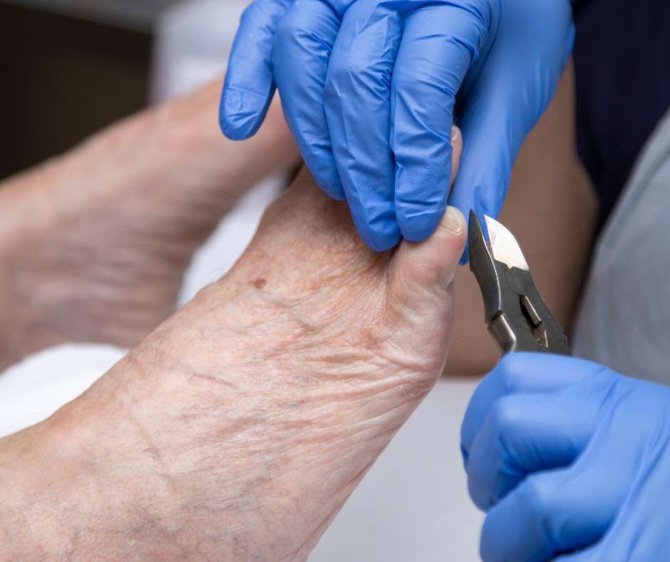 Work Calluses Corns And Calluses: Causes And Prevention – ADQB