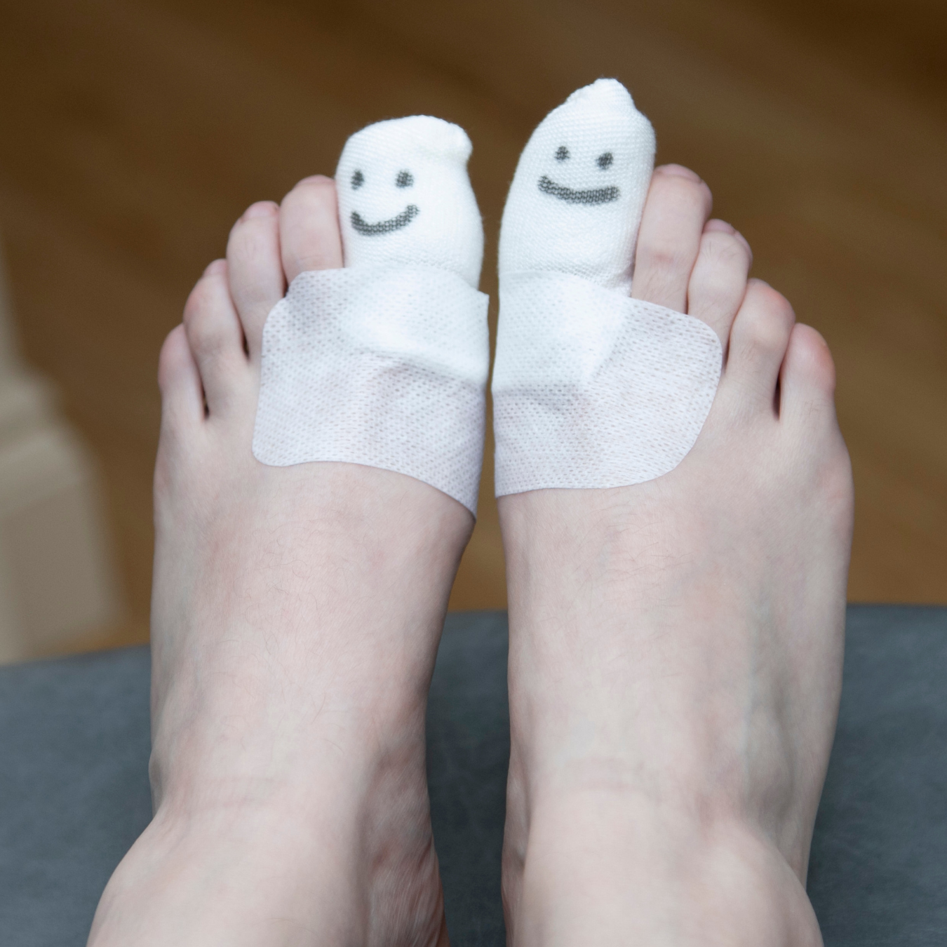 What is Permanent Ingrown Toenail Removal?